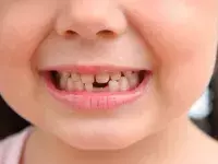 ονειροκρίτης δόντια
