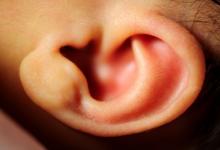 αυτιά oneirokriths